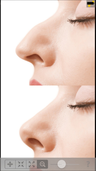 Chirurgie esthétique virtuelle