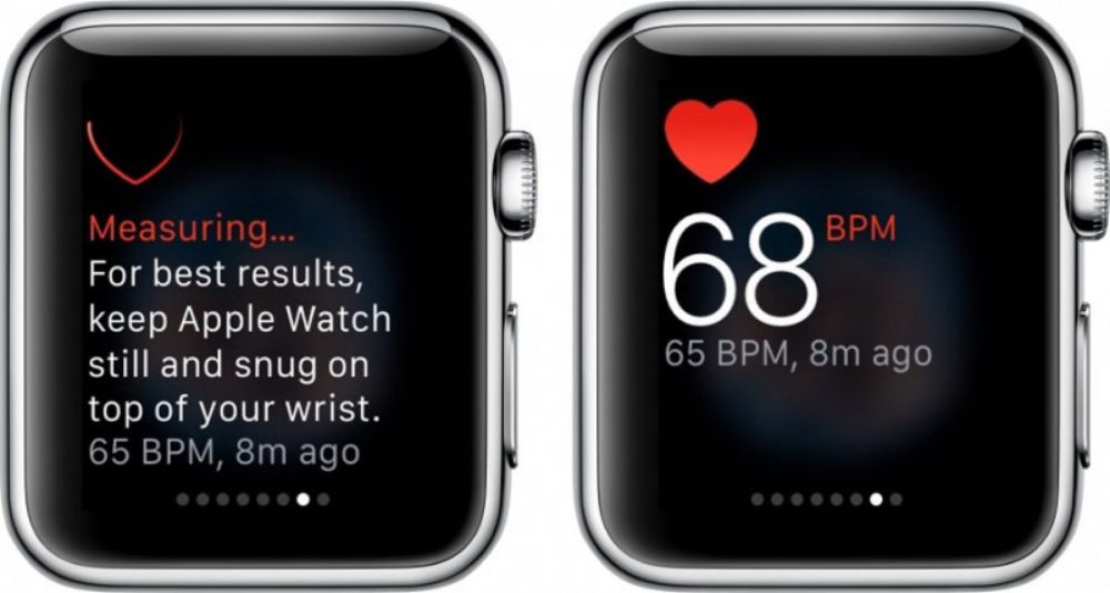 L'Apple Watch pourra détecter les problèmes cardiaques