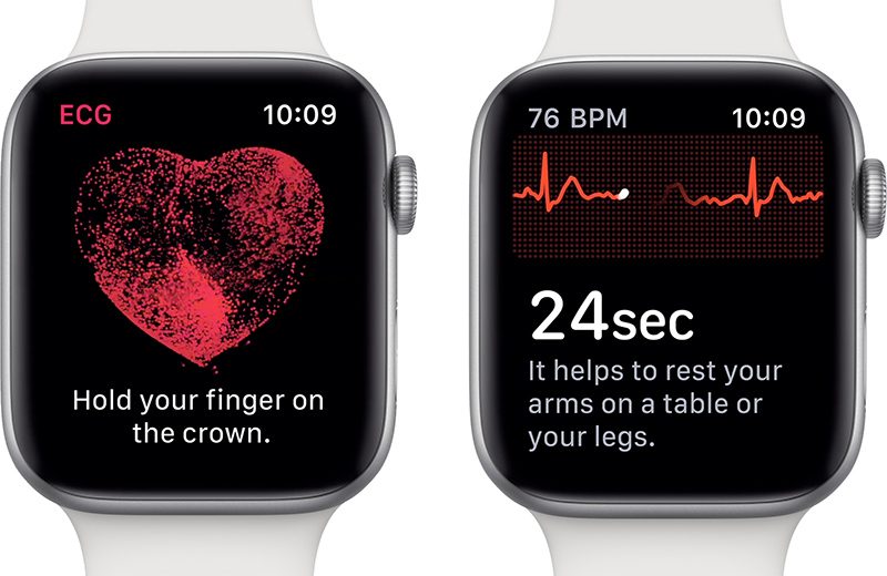 ECG en cours sur l'Apple Watch