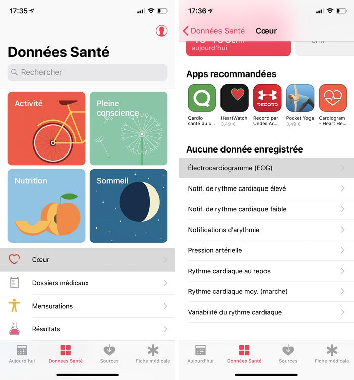 Trouver, configurer l'app ECG dans Santé sur iPhone pour faire et enregistrer un ECG sur l'Apple Watch